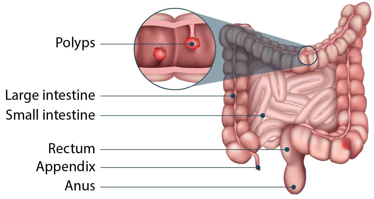 Disease 10